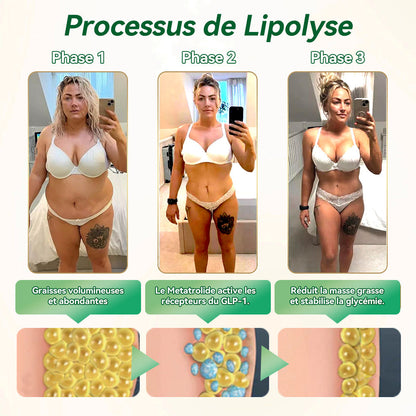 Il ne reste que 10 boîtes ！⏰ Profitez d’une remise exclusive de 30 % ！Recommandé par des endocrinologues : 4 à 6 boîtes pour stabiliser la perte de poids et éviter la reprise. Dernière chance avant l’an prochain ！N’attendez plus ！🔥